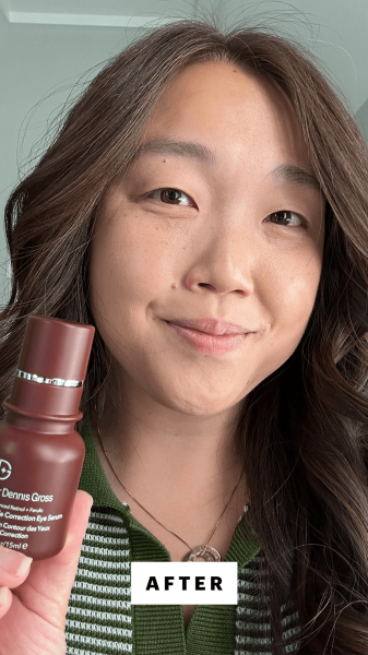 Lee after applying the Dr. Dennis Gross Advanced Retinol  Ferulic Triple Correction Eye Serum